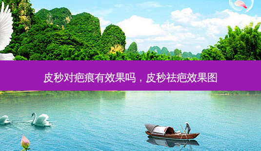 皮秒对疤痕有效果吗,皮秒祛疤效果图-第1张图片-美呗严选网 皮秒对疤痕有效果吗,皮秒祛疤效果图-第1张图片-美呗严选网