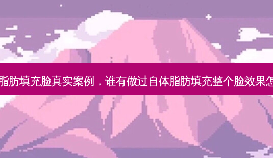 自体脂肪填充脸真实案例,谁有做过自体脂肪填充整个脸效果怎么样-第1张图片-美呗严选网 自体脂肪填充脸真实案例,谁有做过自体脂肪填充整个脸效果怎么样-第1张图片-美呗严选网