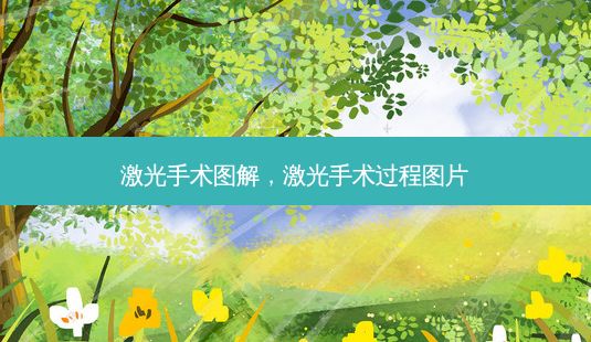 激光手术图解,激光手术过程图片-第1张图片-美呗严选网 激光手术图解,激光手术过程图片-第1张图片-美呗严选网