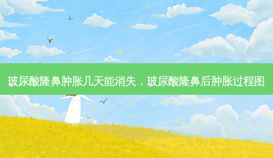 玻尿酸隆鼻肿胀几天能消失,玻尿酸隆鼻后肿胀过程图-第1张图片-美呗严选网 玻尿酸隆鼻肿胀几天能消失,玻尿酸隆鼻后肿胀过程图-第1张图片-美呗严选网