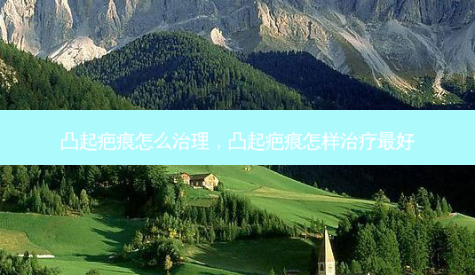 凸起疤痕怎么治理,凸起疤痕怎样治疗 *** -第1张图片-美呗严选网 凸起疤痕怎么治理,凸起疤痕怎样治疗 *** -第1张图片-美呗严选网