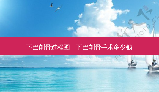 下巴削骨过程图,下巴削骨手术多少钱-第1张图片-美呗严选网 下巴削骨过程图,下巴削骨手术多少钱-第1张图片-美呗严选网