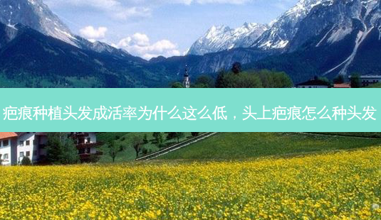 疤痕种植头发成活率为什么这么低,头上疤痕怎么种头发-第1张图片-美呗严选网 疤痕种植头发成活率为什么这么低,头上疤痕怎么种头发-第1张图片-美呗严选网