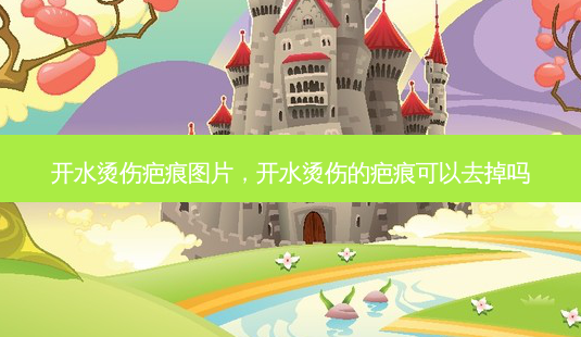 开水烫伤疤痕图片,开水烫伤的疤痕可以去掉吗-第1张图片-美呗严选网 开水烫伤疤痕图片,开水烫伤的疤痕可以去掉吗-第1张图片-美呗严选网