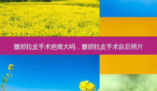 腹部拉皮手术疤痕大吗,腹部拉皮手术前后照片-第1张图片-美呗严选网 腹部拉皮手术疤痕大吗,腹部拉皮手术前后照片-第1张图片-美呗严选网
