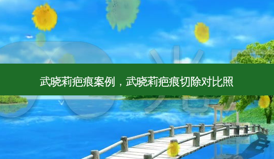 武晓莉疤痕案例,武晓莉疤痕切除对比照-第1张图片-美呗严选网 武晓莉疤痕案例,武晓莉疤痕切除对比照-第1张图片-美呗严选网