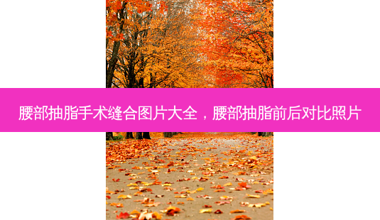 腰部抽脂手术缝合图片大全,腰部抽脂前后对比照片-第1张图片-美呗严选网 腰部抽脂手术缝合图片大全,腰部抽脂前后对比照片-第1张图片-美呗严选网