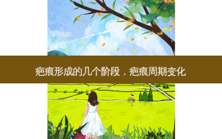 疤痕形成的几个阶段，疤痕周期变化
