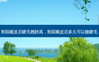 割双眼皮后睫毛翘好高，割双眼皮后多久可以接睫毛