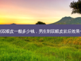 男生割双眼皮一般多少钱，男生割双眼皮前后效果一样吗