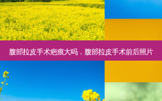 腹部拉皮手术疤痕大吗，腹部拉皮手术前后照片